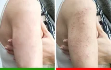 Điều gì xảy ra với cơ thể nếu ngồi quá nhiều?