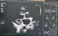 Cảnh báo: Hiểm hoạ tim mạch khôn lường vì tiêm thuốc giảm đau vào khớp tại phòng khám tư nhân