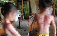 Người phụ nữ hắt nước sôi khiến 3 mẹ con hàng xóm bỏng nặng