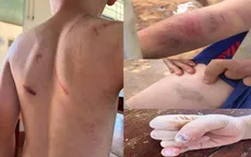 Vụ cháu bé 9 tuổi bị đánh đập ở Đắk Lắk: Khởi tố bà nội và cha ruột