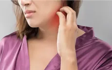 Viêm da dị ứng có thể ảnh hưởng đến sức khỏe tâm thần ra sao?