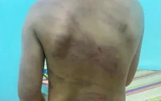 Bé gái 7 tuổi nghi bị bạo hành với nhiều vết thương trên người