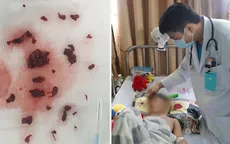Bé mới 4 tuổi đã bị đột quỵ não, bác sĩ cảnh báo thực trạng đáng lo ngại