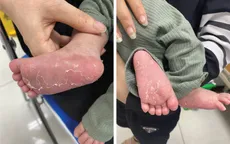 Ngỡ ngàng phát hiện con mới 46 ngày tuổi đã mắc bệnh... giang mai