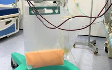 Cứu sống nữ bệnh nhân có huyết tương trắng đục như sữa