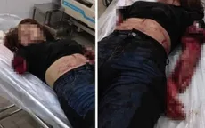 Vì ghen tuông, chồng chém đứt lìa 2 tay vợ