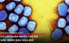 Nhiều trẻ em Mỹ mắc bệnh đậu mùa khỉ