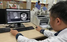 Cảnh báo các ca nhập viện gia tăng do uống rượu bia