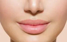 Cải thiện làn môi khô nứt nẻ mà không cần son dưỡng