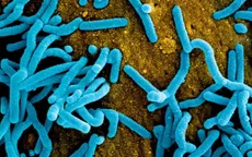 Marburg - virus bị WHO cảnh báo nguy hiểm đến mức nào?