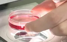 Tiến bộ mới nâng cao hiệu quả điều trị vô sinh, hiếm muộn