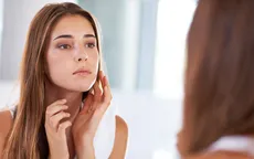 Những cách hạ gục mụn nhanh chóng