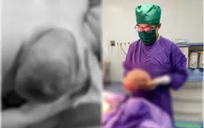 Bóc tách khối u vú nặng 3kg cho nữ bệnh nhân