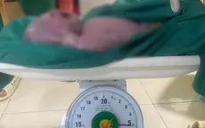 Mổ bắt thành công bé sơ sinh nặng 5,4kg cho sản phụ 21 tuổi