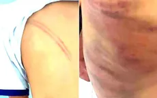 Khởi tố mẹ kế đánh con chồng ở Cà Mau