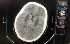 Bệnh viện Bạch Mai thông tin về vụ nhiễm độc methanol ở Bắc Ninh