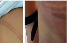 Bố vắng nhà, bé lớp 1 bị mẹ kế bạo hành