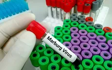 Bùng phát virus Marburg gây tử vong cao ở Tanzania