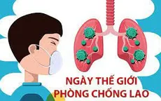 Việt Nam vẫn là nước có gánh nặng bệnh lao cao