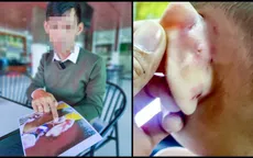 Khởi tố cô giáo mầm non đánh trẻ gây thương tích ở Kiên Giang