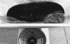 Cắt bỏ lá lách nặng 4kg dọa vỡ cho bệnh nhân