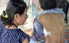 Người phụ nữ bị chồng 'hờ' ở An Giang bạo hành dã man