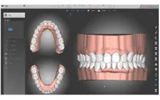 Biết trước kết quả là yếu tố quyết định thành công của ca niềng răng