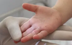 TP. Hồ Chí Minh: Ca mắc tay chân miệng, sốt xuất huyết tăng