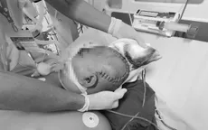 Gắp viên đạn cho bé trai bị súng bắn vào đầu