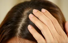 Những yếu tố gây ra tóc bạc