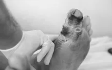 Những biến chứng nguy hiểm của bệnh tiểu đường không thể bỏ qua