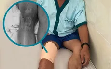 Nguy hại khôn lường khi chữa bệnh bằng "mẹo vặt dân gian"