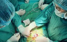 Cứu bé sơ sinh trải qua 4 lần đại phẫu trong 20 ngày đầu đời