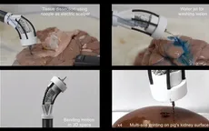 Giáo sư gốc Việt chế tạo robot in 3D ngay trong cơ thể người lần đầu tiên trên thế giới