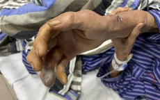 Nhiều người dân bị rắn độc cắn tại nhà