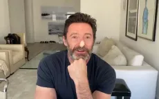 "Người sói" Hugh Jackman tiết lộ nỗi sợ ung thư da, kêu gọi người hâm mộ bôi kem chống nắng