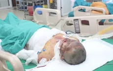 Bị bỏng nặng khi đi đốt nương, 2 mẹ con người dân tộc Mông cần giúp đỡ