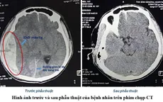 Lãnh đạo bệnh viện ký giấy mổ cứu sống bệnh nhân bị tai nạn giao thông khi không có người nhà