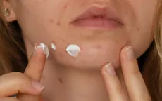 4 sản phẩm làm đẹp tiềm ẩn nguy cơ "tàn phá" làn da