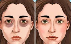 8 lợi ích không ngờ khi đi bơi thường xuyên