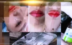 Lưu ý đặc biệt quan trọng khi đến làm đẹp tại các cơ sở thẩm mỹ