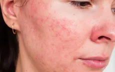 10 tình trạng về da phổ biến nhất bạn cần biết