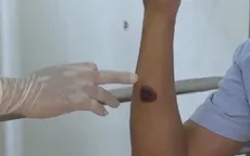 Khẩn trương kiểm soát, không để dịch bệnh than lây lan trên diện rộng