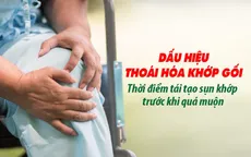 Dấu hiệu thoái hóa khớp gối - Thời điểm tái tạo sụn khớp trước khi quá muộn