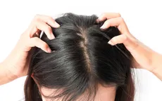 Làm thế nào để đối phó với gàu?