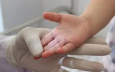 TP. Hồ Chí Minh chỉ đạo tăng cường phòng chống bệnh tay chân miệng