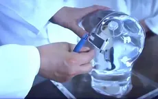 Thiết bị hỗ trợ điều trị bệnh nhân mắc chứng động kinh
