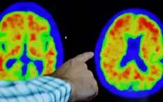 Thêm loại thuốc hứa hẹn làm chậm quá trình Alzheimer