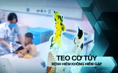 Teo cơ tủy - Bệnh hiếm nhưng không hiếm gặp