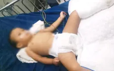 Bé 2 tuổi bị rắn hổ mang cắn khi ngủ trưa hồi phục tốt